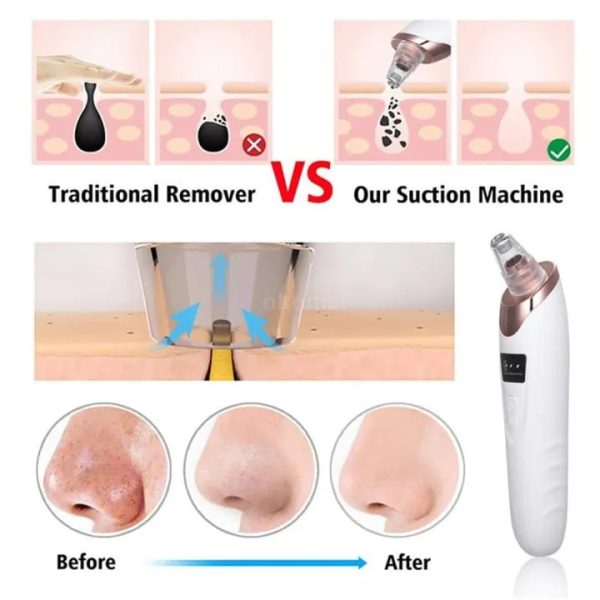 USB Rechargeable Blackhead Remover with LED Light - 4 Suction Heads & 3 Adjustable Levels