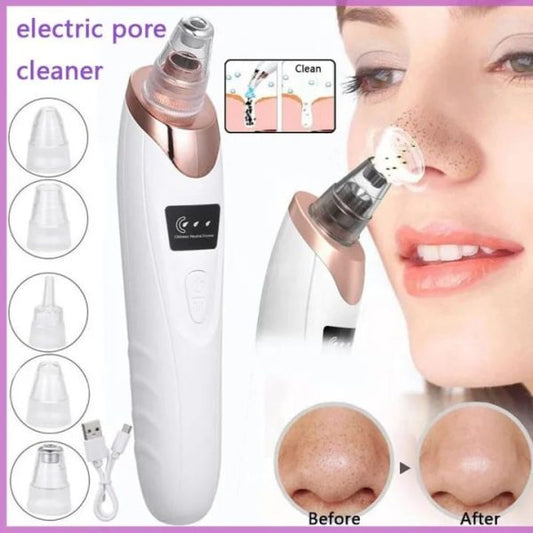 USB Rechargeable Blackhead Remover with LED Light - 4 Suction Heads & 3 Adjustable Levels